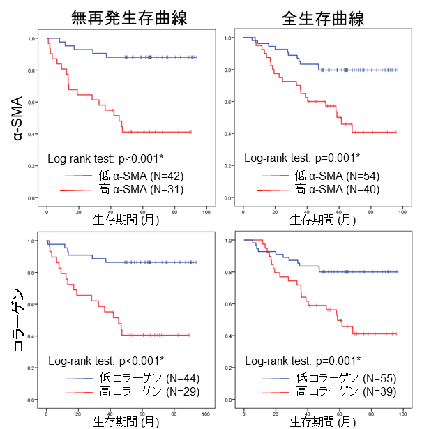 転移リンパ節の線維化は大腸癌における予後不良因子である