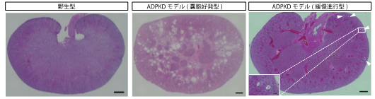 PKD1に変異を持つサルはヒトの常染色体優性多発性嚢胞腎を再現する。