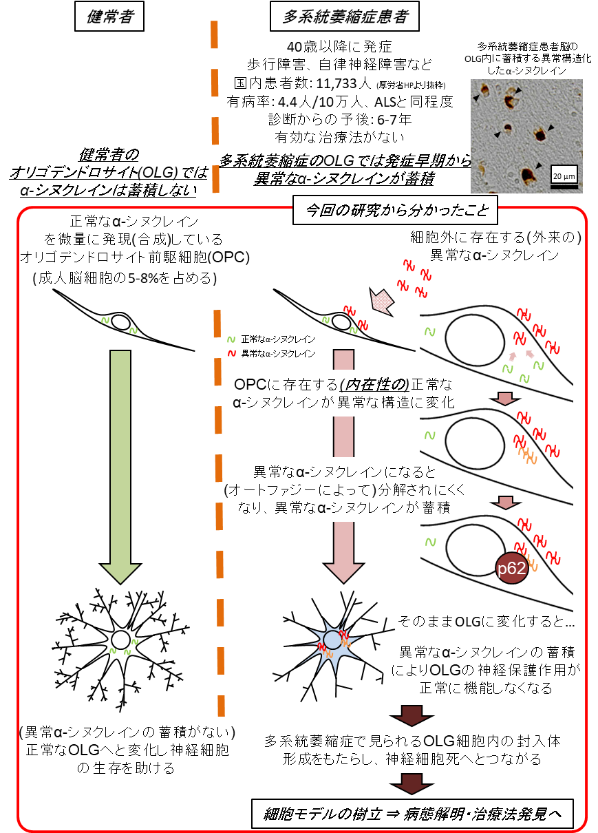 画像　Pathological Endogenous α-Synuclein Accumulation in Oligodendrocyte Precursor Cells Potentially Induces Inclusions in Multiple System Atrophy